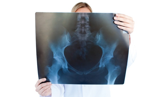 노인 건강 위협하는 고관절 골절 노인 건강 위협하는 고관절 골절